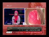 مع الشعب مع احمد المغربل| وكيفية أكتشاف لحم الحمير والفرق بينه وبين اللحم البلدي 1-5-2018