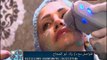 د.ولاء ابو الحجاج تكشف عن أحدث تقنية لعلاج تجاعيد البشرة دون حقن خيوط عن طريق جهاز 