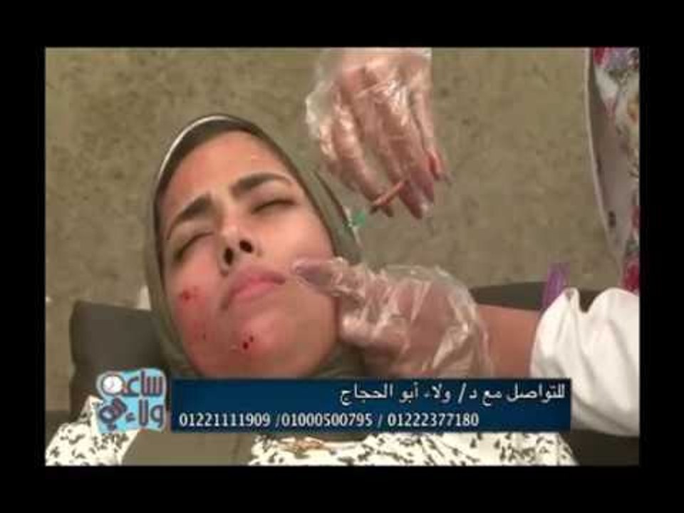 ساعة مع ولاء مع د.ولاء ابو الحجاج| حقن البلازما ونصائح للتخسيس 4-6-2018