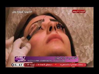 د ولاء ابو الحجاج تقوم بجلسة حقن فيلر بالخدود وبوتكس بالجبهة