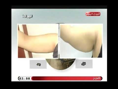 طبيب الحدث مع أهداب الدسوقي|استشاري جراحة التجميل د.محمد قرني حول النحت الديناميكي14-7-2018