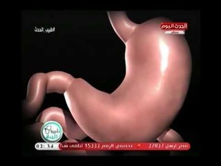 طبيب الحدث مع أهداب الدسوقي| لقاء د.أحمد سفينة  إستشاري جراحات السمنة المفرطة18-7-2018