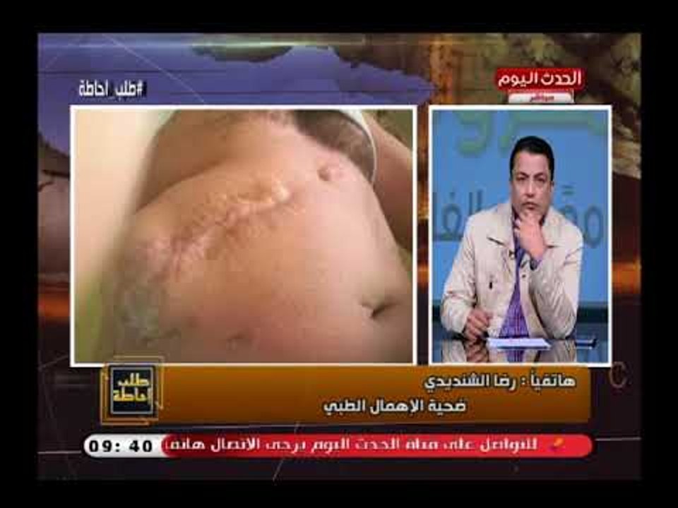 برنامج طلب إحاطة يتبنى حالة عم رضا ضحية الإهنال الطبي أثناء عملية المراراة بعلاجه داخل معهد ناصر