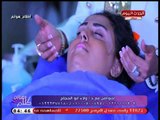 فيديو| د.ولاء ابو الحجاج تقوم بجلسة لعلاج البهاق