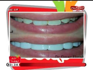 لأنك تهمنا مع شذا شعبان| د.عمر المهدي اخصائي التركيبات الثابتة وتجميل الاسنان 8-9-2018