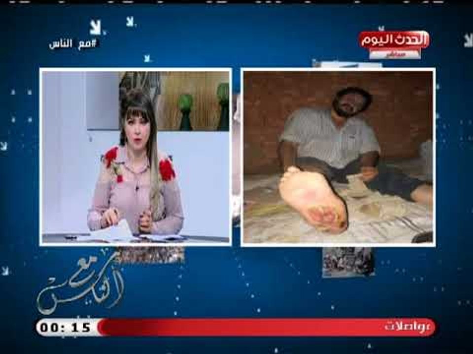 حالة انسانية تستغيث بسبب تدهور حالته الصحية وبتر اصابع قدمه بسبب مرض السكر