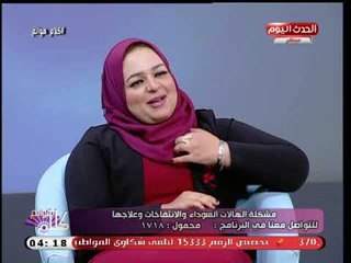 كلام هوانم مع عبير الشيخ| علاج الهالات السوداء مع خبيرة التجميل د. راندا عوض 23-9-2018