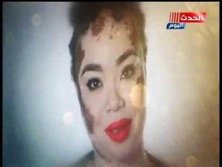 #البهاق_مجرد_لون  #كلام_هوانم يطلق مبادرة بالتعاون مع د.ولاء ابو الحجاج لعلاج مرضى البهاق بخصم 50%