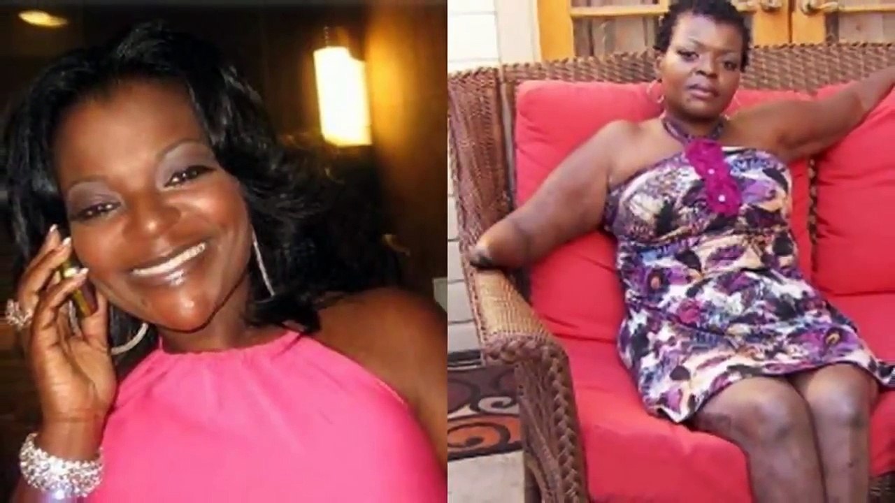 When Plastic Surgery Goes Wrong-Rated Educational