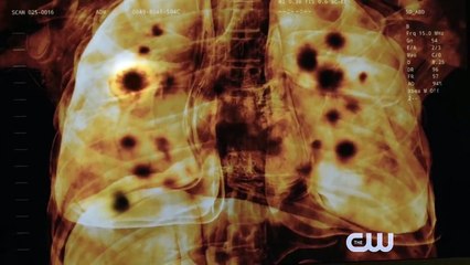 The 100 Season 5 Episode 8 Sneak Peek #2 How We Get to Peace (2018)