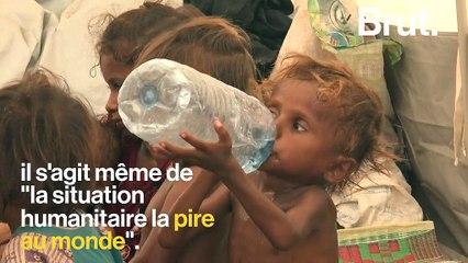 Le Yémen fait face à "la pire situation humanitaire du monde"