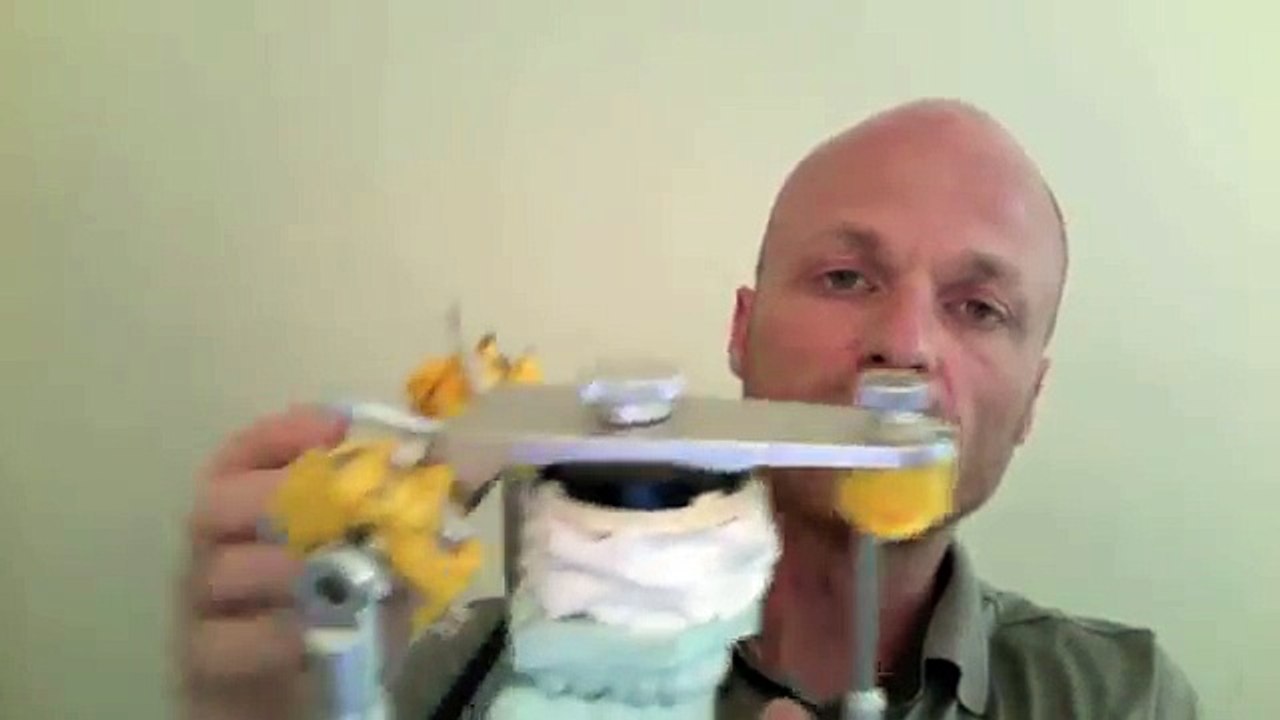 Neues über unser Kiefergelenk