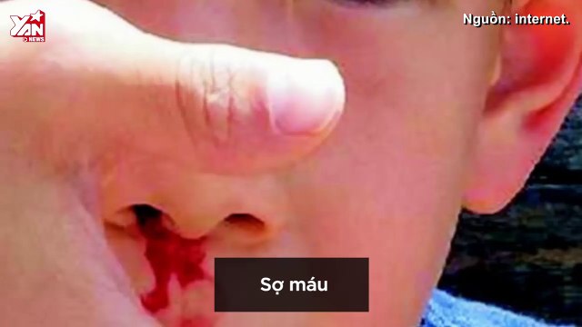 Giải Mã Nỗi Sợ: những nỗi ám ảnh làm bật lên tính cách của bạn