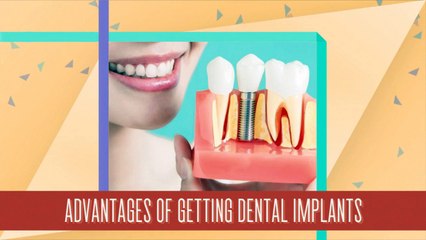 Advantages of Getting Dental Implants