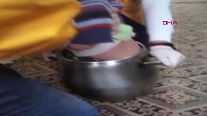 Ağrı 2 Yaşındaki Minik Düdüklü Tencereye Sıkıştı