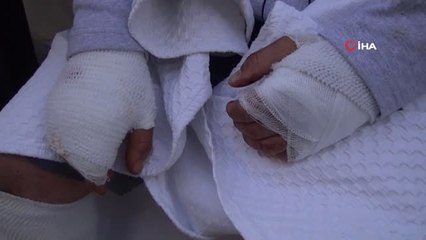 Mantar Toplarken Ayının Saldırısına Uğrayan Vatandaş Konuştu: "Ayıyla 15 Dakika Mücadele Ettim, En...