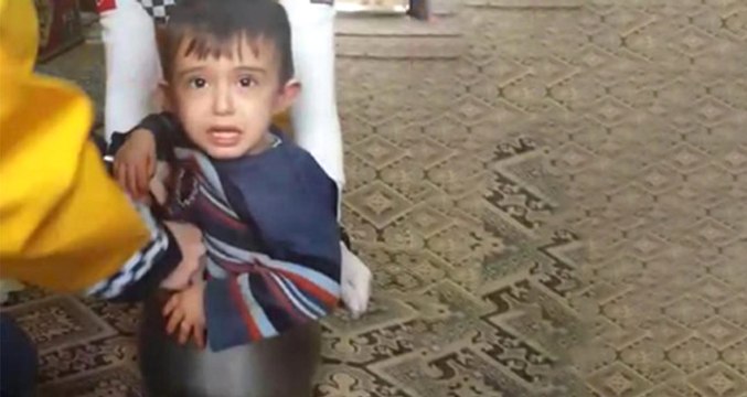 2 Yaşındaki Erkek Çocuğu, Düdüklü Tencereye Sıkıştı
