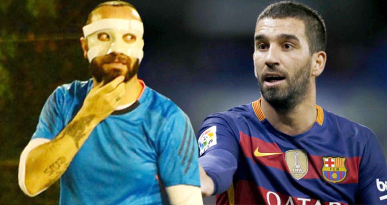 Arda Turan Tarafından Burnu Kırılan Berkay Şahin, Özel Bir Maske Takarak Halı Saha Maçı Yaptı