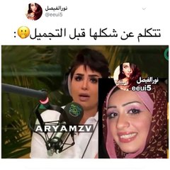 هنادي الكندري تكشف حقيقة صورها القديمة قبل التجميل "هذه ليست أنا"