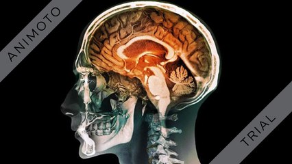 Master Mindboost- *Must* Read Review Before Buy