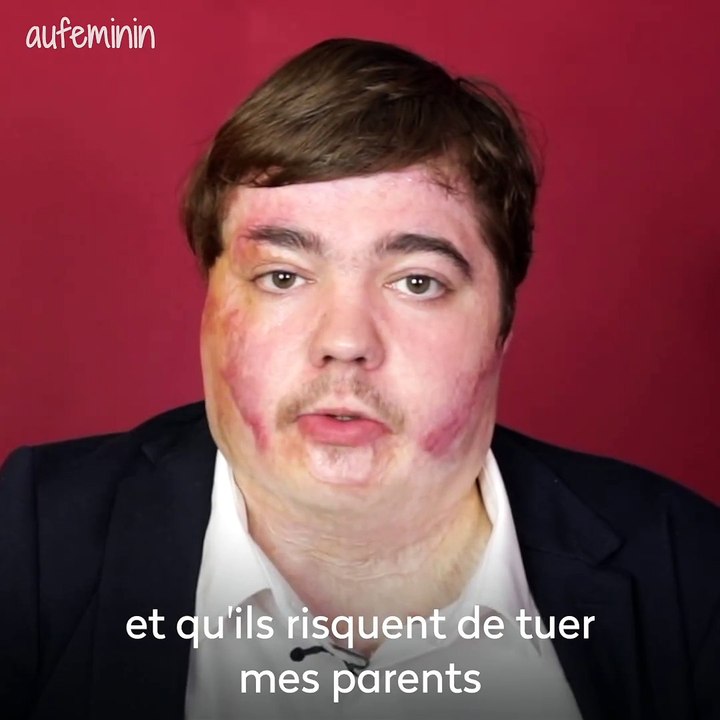 "Le jour où j’ai brûlé mon coeur", lundi prochain à 21h00 sur TF1 : Découvrez le témoignage de Jonathan Destin