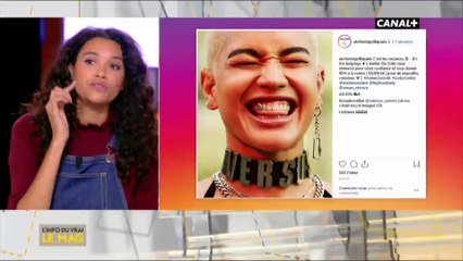 Un bijou pour les dents... - L'info du vrai du 01/11 - CANAL+