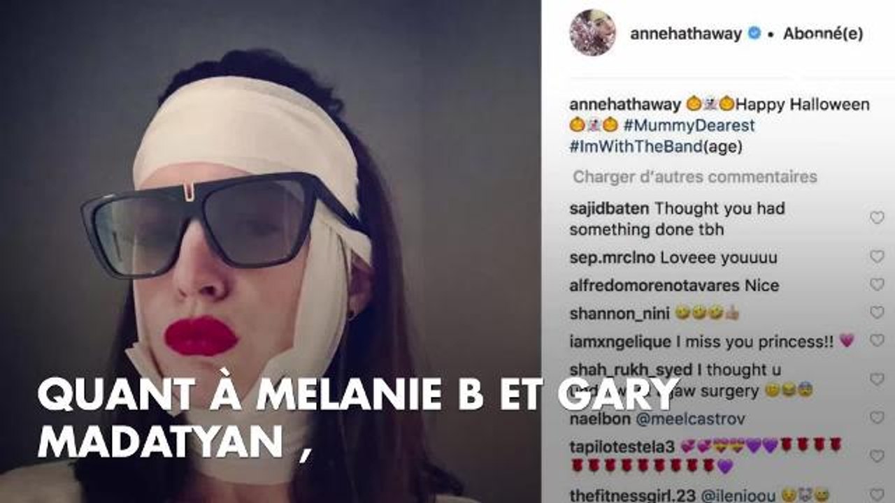 PHOTOS. Halloween 2018 : Katy Perry, Avril Lavigne, Paris Hilton... les plus gros flops des déguisements des stars