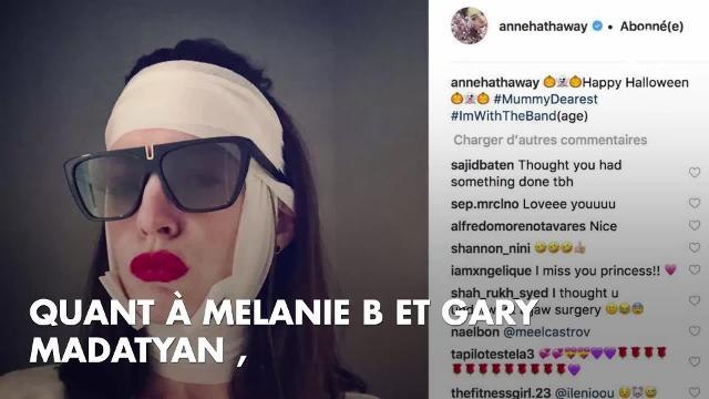 PHOTOS. Halloween 2018 : Katy Perry, Avril Lavigne, Paris Hilton... les plus gros flops des déguisements des stars