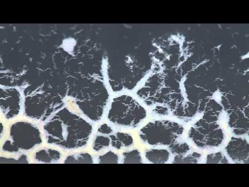 Microworms