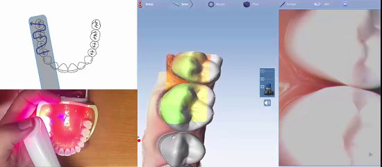 Planmeca PlanScan Full Arch Scanning Technique