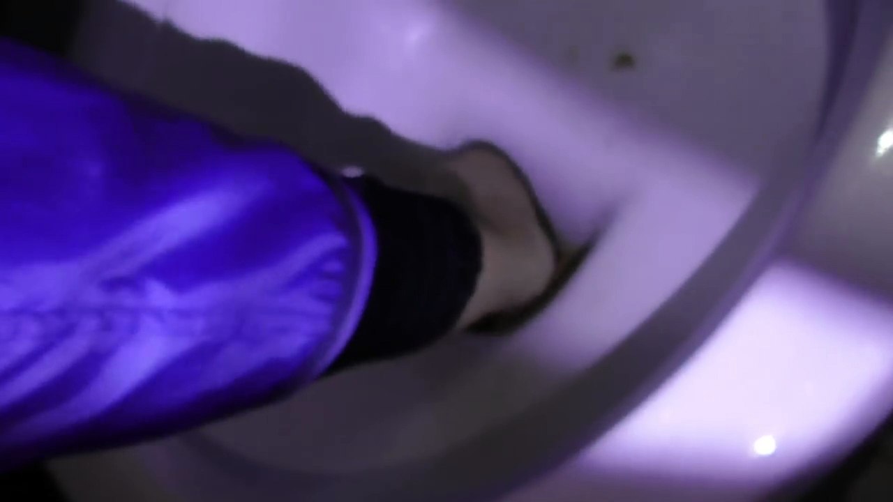 Matteo Montesi infila le mani in un cesso e si taglia la mano