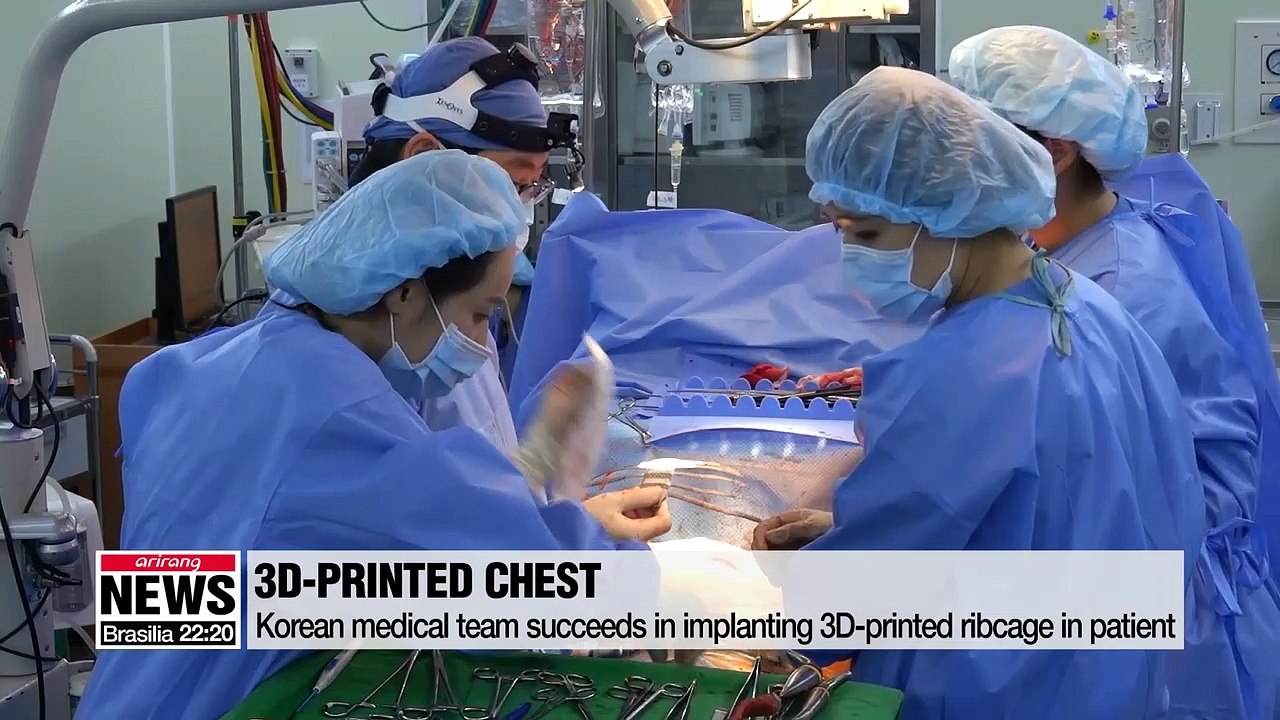 Korean medical team succeeds in implanting 3D-printed ribcage in patient