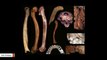 Anthropologist Suggests Apparent Abundance Of Early-Human Deformities Is Linked To Inbreeding