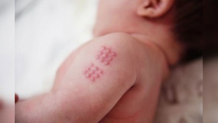 '비소 검출' BCG 경피용 불안 커져...보건당국 "안전" / YTN