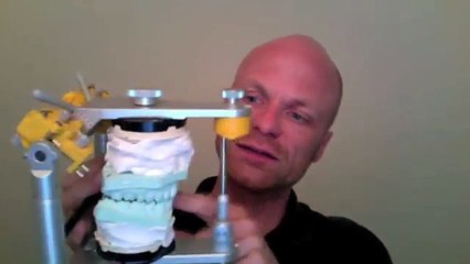 Wofür dient der Artikulator beim Zahnarzt