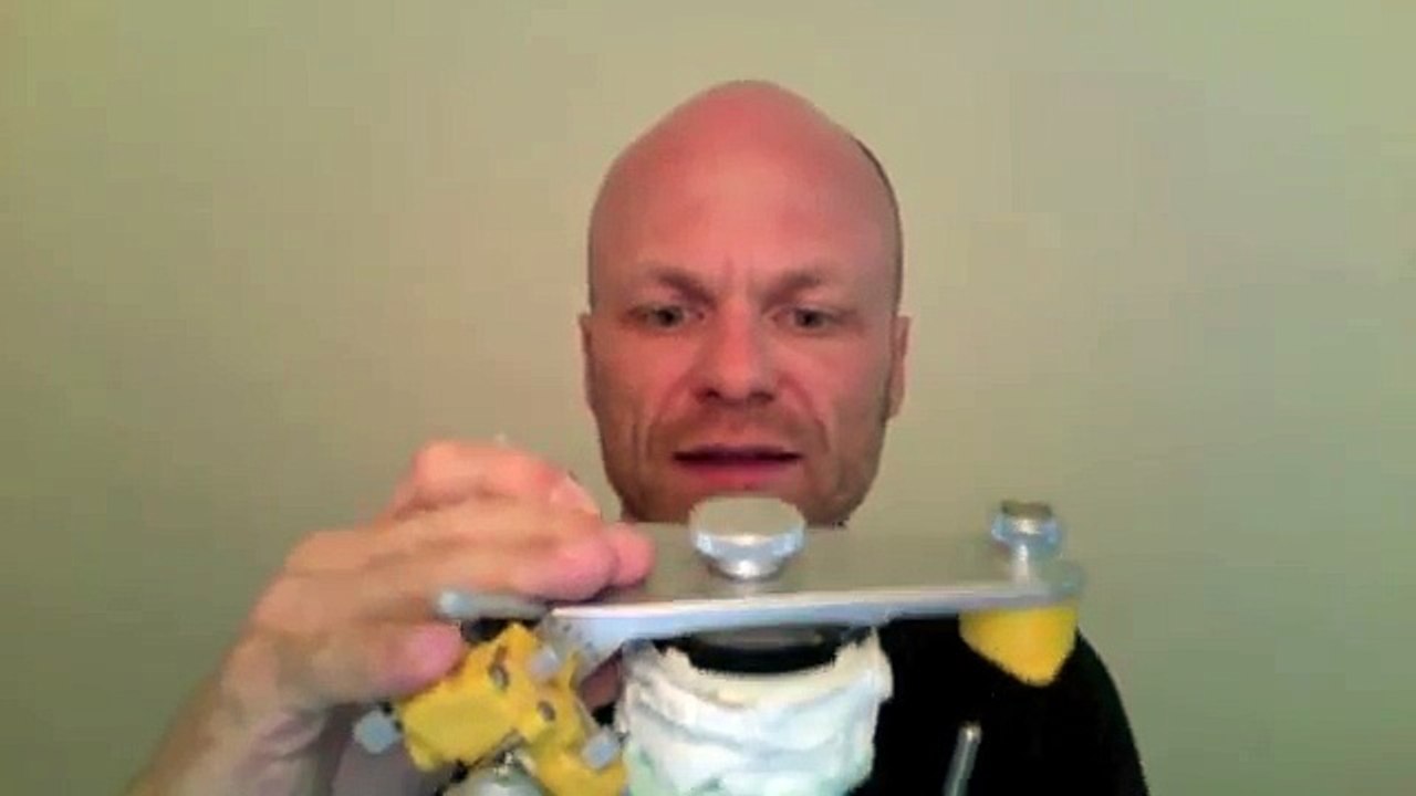 Bringt die Funktionsanalyse des Unterkiefers etwas