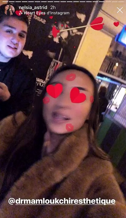 Astrid Nelsia : elle dévoile ses nouvelles lèvres après plusieurs injections !