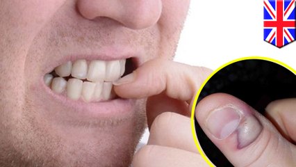 爪噛むクセで死にかけた男性  - トモニュース