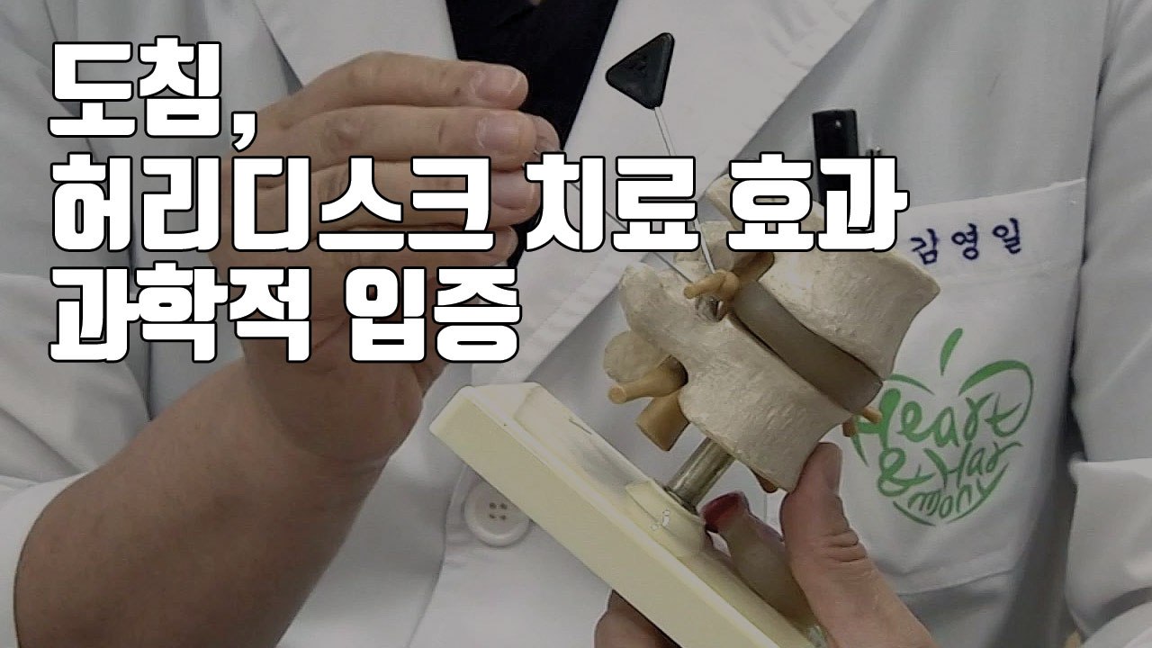[자막뉴스] 도침, '허리디스크 치료 효과' 과학적 입증 / YTN