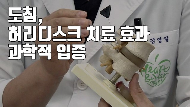 [자막뉴스] 도침, '허리디스크 치료 효과' 과학적 입증 / YTN
