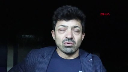 Ünlü Youtuber ve Arkadaşı Yangında Dumandan Zehirlenerek Öldü 4