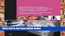 D.O.W.N.L.O.A.D [P.D.F] Skeletal Anchorage in Orthodontic Treatment of Class II Malocclusion: