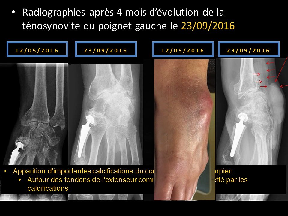 Un poignet crémeux