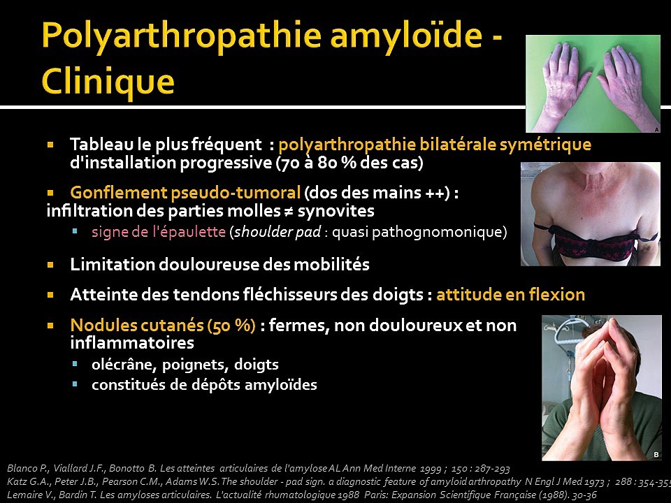Un ami qui dépote