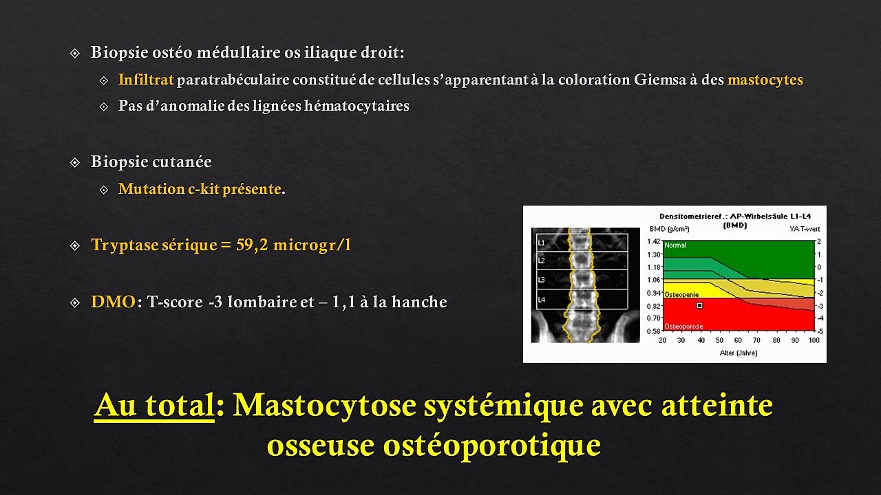 Quand supersquelette se gratte...