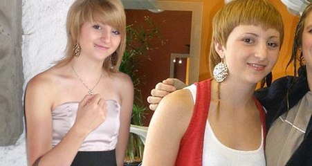 Arkadaşlarının Alay Ettiği Genç Kız, 40 Bin Dolar Harcayarak Başka Biri Oldu