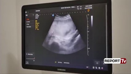 Report TV - 62-vjeçarja italiane, nënë për herë të parë falë një çifti shqiptar