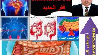 Les conséquences de la carence martiale au-dela de l'anémie  نتائج فقر الحديد ما وراء فقر الدم