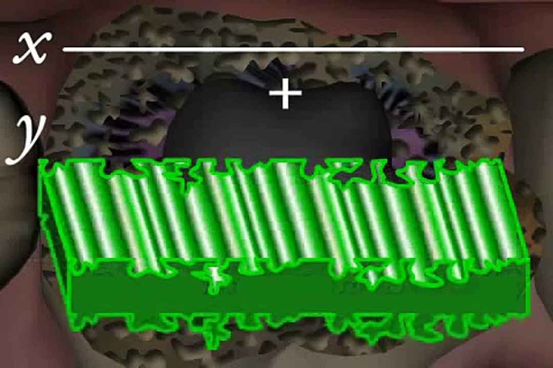 Fehler beim Keramikinlay kleben - Bonding