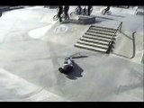 - SKATER BREAKS HIS LEGTO -